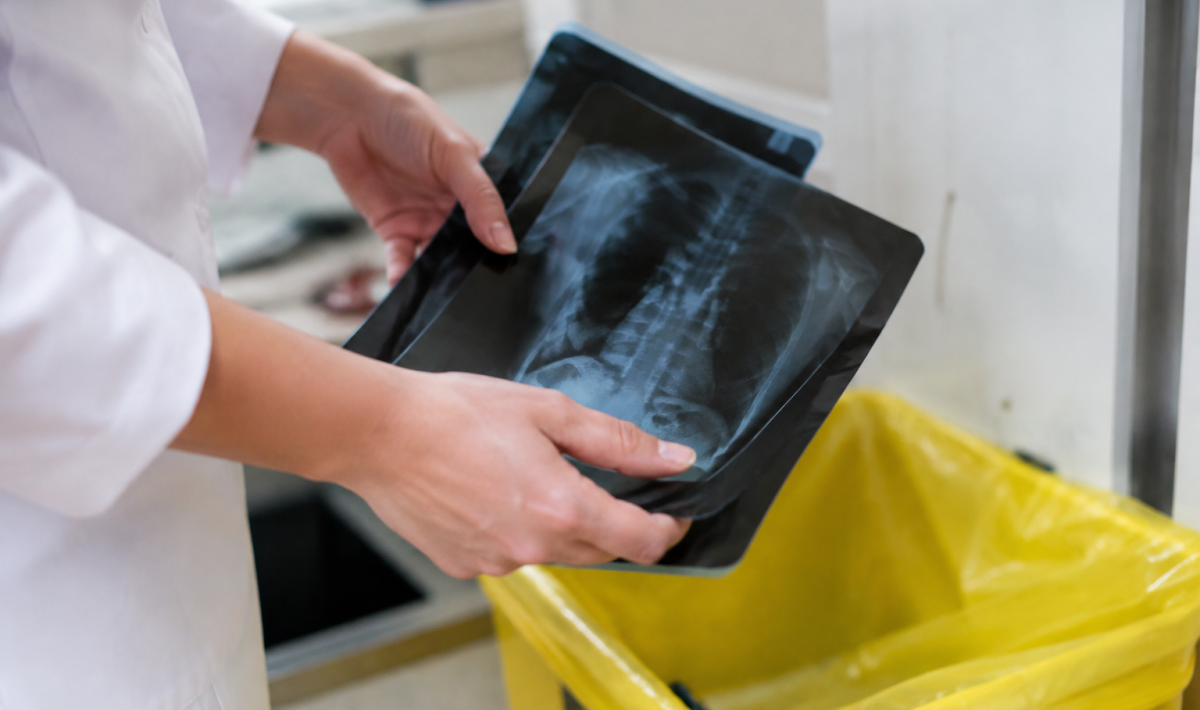 Mains versant films radiographiques bac jaune
